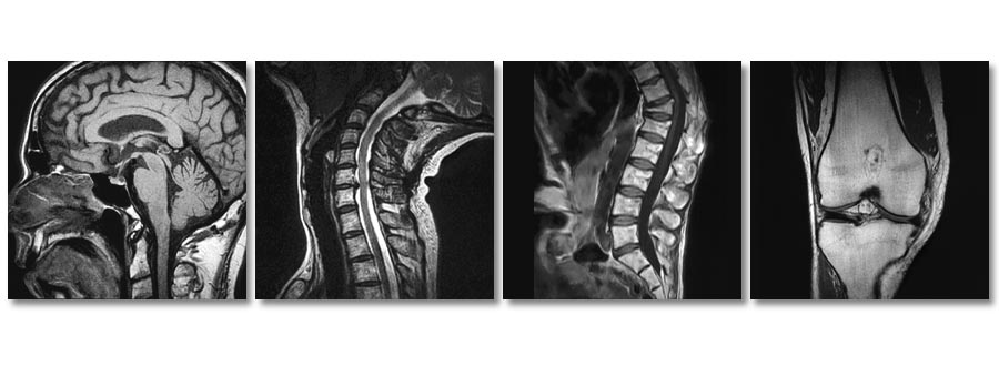 StandUp MRI of East SetauketI